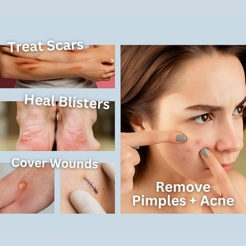 Hydrocolloid Skin Healing Roll